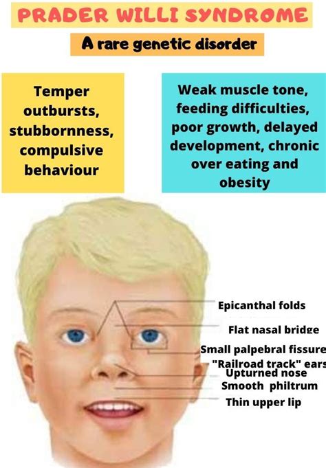 diseases similar to prader willi syndrome